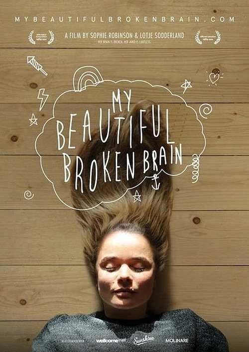 Обложка (Постер) Мой прекрасный сломанный мозг / My Beautiful Broken Brain (2014) HDRip Обложка (Постер) Мой прекрасный сломанный мозг / My Beautiful Broken Brain (2014) HDRip