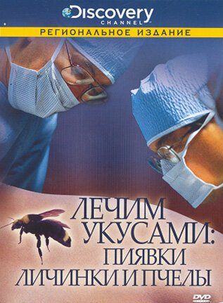 Обложка (Постер) Discovery: Лечим укусами. Пиявки, личинки и пчелы / Leeches, Maggots and Bees: The Bite that Cures (2000) HDRip